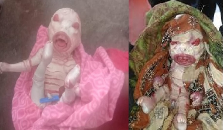 महिला ने दिया एलियन बेबी का जन्म, देखने वालों का लगा ताता... - UP Samachar